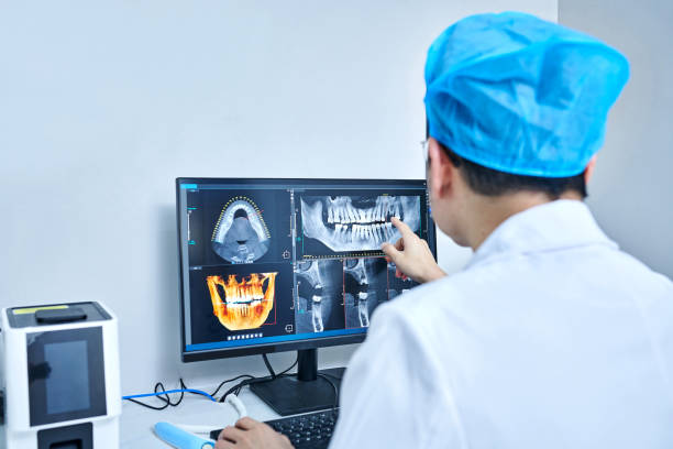 Best Emergency Dentist for Lost Fillings or Crowns in Rancho Santa Fe, CA